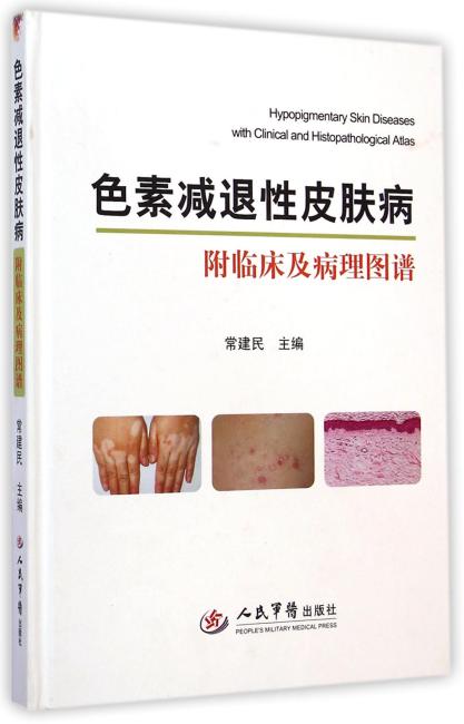 色素减退性皮肤病：附临床及病理图谱