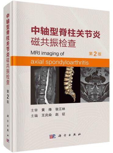 中轴型脊柱关节炎磁共振检查（第2版）