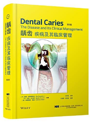 龋齿疾病及其临床管理 第3版