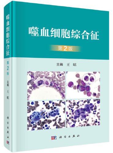 噬血细胞综合征（第2版）