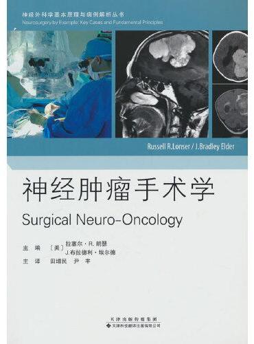 神经肿瘤手术学