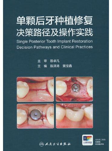 单颗后牙种植修复决策路径及操作实践