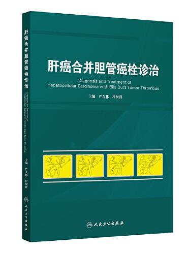 肝癌合并胆管癌栓诊治