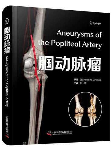 腘动脉瘤 国际经典血管外科学译著